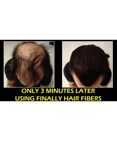 Finally Hair Fiber Lock Strong Hold Spray - Compatible with Toppik, Xfusion, Febron, Bosley, Nanogen - Buy Online on GoSupps.com