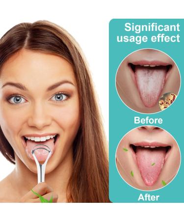 Buy Weddhuis 2 PCs Tongue Cleaner - Double Scraping Metal Tool for Bad Breath & Oral Hygiene | Effective Tongue Scraper for Adults - Fast International Shipping - Buy Online on GoSupps.com
