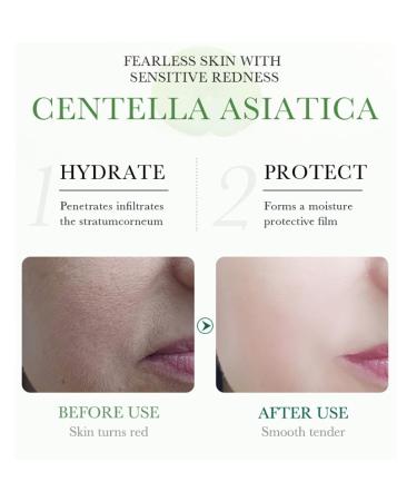 Centella Asiatica Soothing Repair Facial Serum | Lightweight Hydrating Daily Moisturizer | Anti-Acne & Oil Control | 30ml - International Shipping - Buy Online on GoSupps.com