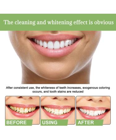 Ampoule Toothpaste & Serum - 3V Fruit Acid Tooth Whitening Essence | International Shipping Available - Buy Online on GoSupps.com