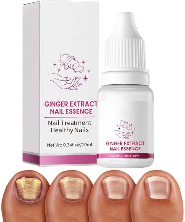 Strengthener for Damaged Nails Versatile Repair Care 10ml Cuticle Repair Oil - Yellow Foot and Nail Care - Ingrown Toenail Prevention - Men and Women - Buy Online on GoSupps.com