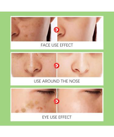  JIAOY Enhanced Spot Remover Oil 577 Spot Correcting Hydrating Water 577 Freckle Serum Spot Remover Serum Skin Hydration & Firming (2PCS) - Buy Online on GoSupps.com