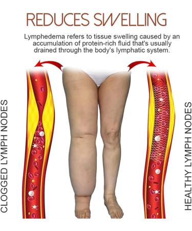 Mediginger Anti-Swelling & Cellulite Firming Ointment for Legs (5PCS) - Buy Online on GoSupps.com