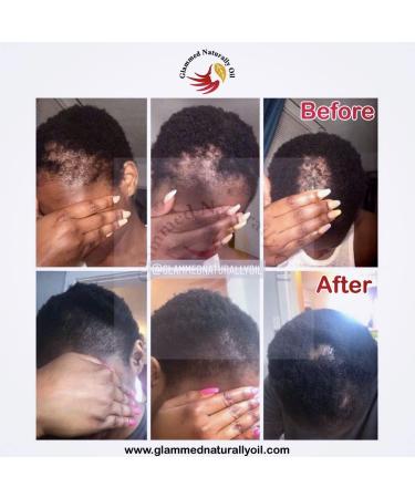 Glammed Naturally Hair Growth Oil - 100% Natural 2oz for Kids, Teen, Adult - Buy Online on GoSupps.com