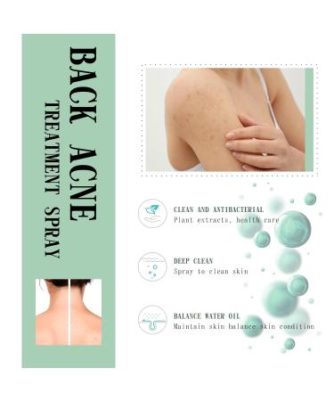 Back Acne Treatment Spray - 2% Salicylic Acid & Herbal Formula - Tea Tree Oil Body Acne Solution - 120ml 2pc - Buy Online on GoSupps.com