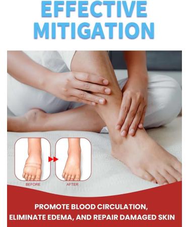 Leg Slimming Massage Cream | Soothing Swelling Tightening Skin Auxiliary Care for Reducing Edema (2 Pieces) - Buy Online on GoSupps.com