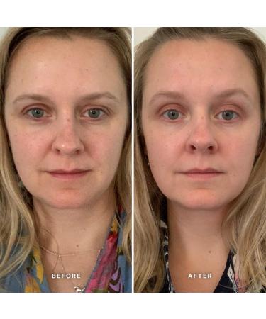 Alpha-H Clarifying Serum Duo - Vitamin A and Vitamin B Serum Bundle - Buy Online on GoSupps.com