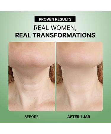 Elir Face & Neck Firming Duo Advanced Anti-Aging Moisturizer Set for Lifted Sculpted Skin Visibly Firms Face Neck & D collet Lightweight Non-Greasy & Dermatologist-Approved - Buy Online on GoSupps.com