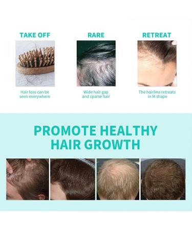 FIOERDTUIE Women Men Hair Growth Essence Roller Natural Ingredient Regrowth Follicle Moisturizing Nourishing Serum Haircare - Buy Online on GoSupps.com
