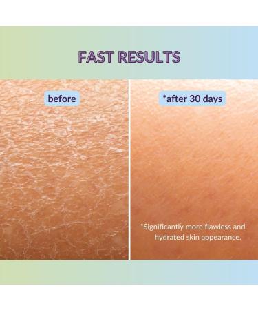 Hyaluronic Acid Moisturiser Gel with Organic Aloe Vera | Natural Vegan Face Care | Intensive Hydration & Anti-Ageing - 100ml - Buy Online on GoSupps.com