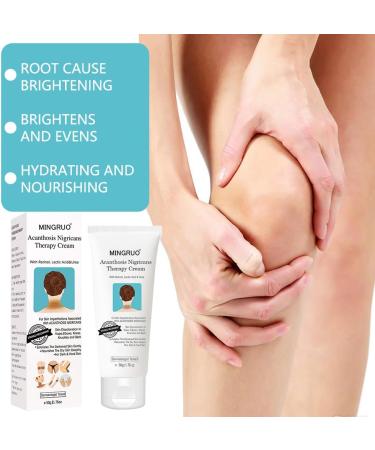 MINGRUO Dark Spot Removal Cream Dark Spot Correction Acanthosis Nigricans Therapy Cream for Dark Skin - Buy Online on GoSupps.com