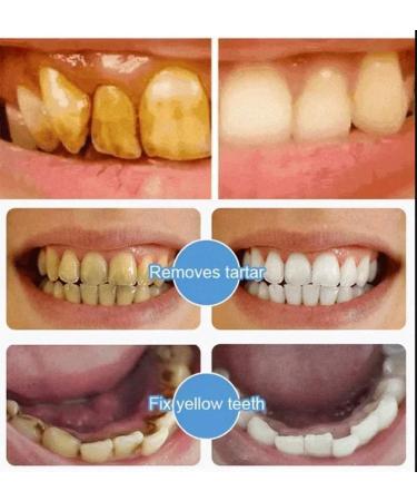 7.5 nHAP Hydroxyapatite Toothpaste - Nano Hydroxyapatite Whiteing Teeth | Enamel Repair | Fluoride-Free | Deep Cleaning Care Oral Health | Breath Freshening | Mild Mint | Sensitive Tooth (2) - Buy Online on GoSupps.com