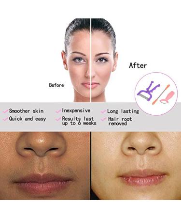  Cankypu Cankypu 3Pcs Hair Remover Spring Facial Hair Removal for Women Spring Face Epilator Removes Hair on the Upper Lip Chin Cheeks & Sideburns - Buy Online on GoSupps.com