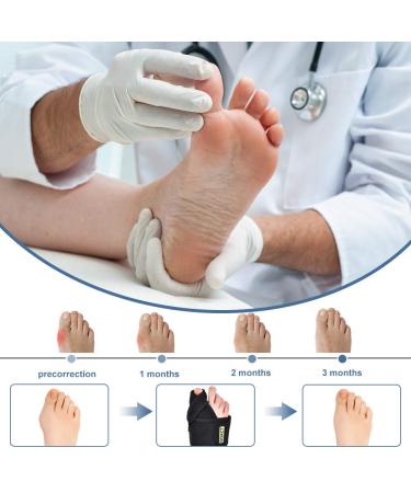 Buy Bunion Corrector for Women | Inflatable Big Toe Separator for Pain Relief | Orthopedic Splint & Non-Surgical Hallux Valgus Solution - Buy Online on GoSupps.com