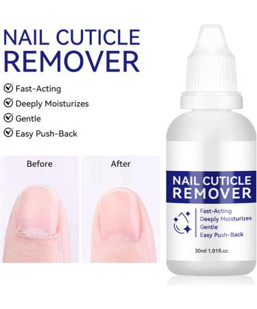 Cuticle Softener Moisturizing Pedicure Supplies 30ml Cuticle Softening Moisturizing Gel - For Dry Damaged Nails Dead Skin Hands Feet Daily Salon Care - Buy Online on GoSupps.com