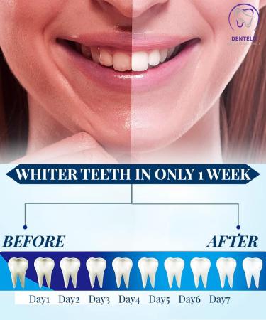5D Teeth Whitening Strips - Enamel Safe for Sensitive Teeth - 14 Sessions - Buy Online on GoSupps.com