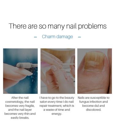 Nail Repair Solution - Moisturizing Oil for Healthy Nails Restored Cuticles & Glossy Finish - Shop Now! - Buy Online on GoSupps.com