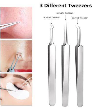 4 pcs Blackhead Remover Comedone Extractor Acne Clip Curved Blackhead Tweezers Kit Professional Stainless Pimple Acne Blemish Removal Tools Kit (Acne 4-Piece Set) - Buy Online on GoSupps.com