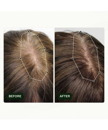 Scandinavian Biolabs Hair Strength Shampoo & Bio-Pilixin Serum for Women | Strengthen & Moisturize Hair with Gentle Clean Formula - International Shipping Available - Buy Online on GoSupps.com