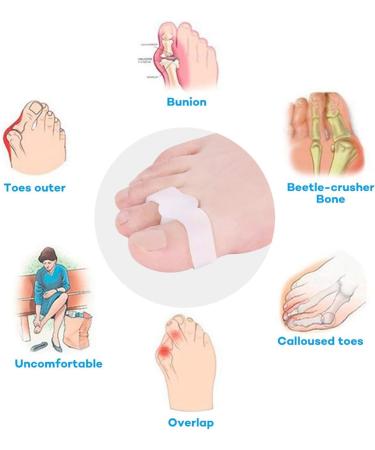 PEDIMEND Silicone Gel Toe Separators (5PAIRS - 10PCS) - Soft Gel Bunion Splint - Reduce Risk of Callus & Corn - for Men & Women - Foot Care (Double Loop Toe Separator) - Buy Online on GoSupps.com