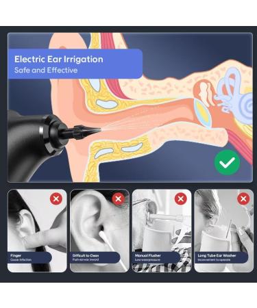 Buy Portable Electric Ear Wax Removal Kit - 10 Nozzles for Effective Ear Cleaning | International Shipping - Buy Online on GoSupps.com