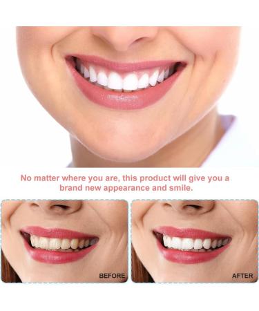 Instant Smile with Teeth Veneers | Fake Teeth for Men & Women | Whiten Bad Teeth | Perfect for Couples - Buy Online on GoSupps.com