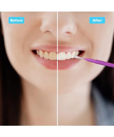 50 PCS Interdental Brush Braces Cleaner - Dental Flossing Head Oral Hygiene Tool Set (5 Colors/Sizes) | PHSZZ - Buy Online on GoSupps.com