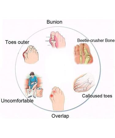 Bunion Splint Flat Sandals for Women - Brown, Size 8 | Comfy Orthopedic Flip Flops for Plantar Fasciitis/Hallux Valgus - Buy Online on GoSupps.com