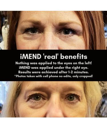 PEAK 10 SKIN iMEND Instant Eye Lift - Tightening Results - 1/2 oz - Buy Online on GoSupps.com