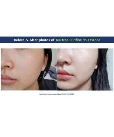 Dr. Ceuracle Tea Tree Purifine 95 Essence 50ml - Purifying & Soothing Serum - Buy Online on GoSupps.com
