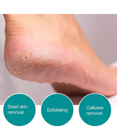 Buy 1pc Glass Foot File - Reusable Dead Skin Exfoliator for Smooth Feet | International Shipping Available - Buy Online on GoSupps.com