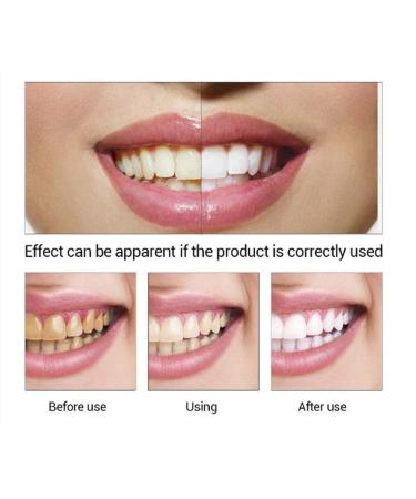Teeth Whitening Serum Gel for Effective Stain Removal - Dental Care Essence - Buy Online on GoSupps.com