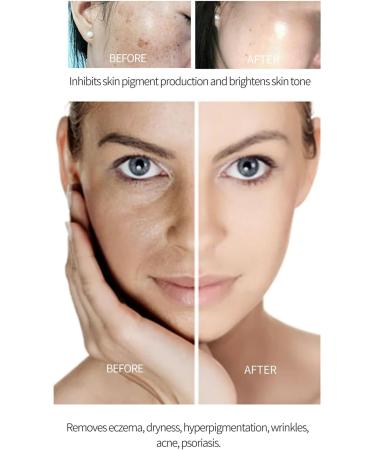 11 Glutathione Whitening Cream 20g antiaging facial cream moisturizer Glutathione White Cream Facial Dark Spots Remover Skin Lightening Cream Face Moisturizer - Buy Online on GoSupps.com