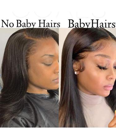 High-Density Lace Front Wig | 20 Curly Real Hair Wig with Baby Hair for Black Women | 150% Brazilian Smooth - Buy Online on GoSupps.com