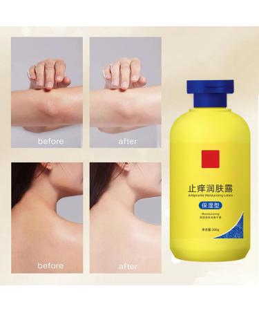 Non-Greasy Anti-Itch Deep Moisturizing Lotion Healing Moisturizing Lotion Intense Healing Body Lotion For Dry Light And Non-Oily Skin (3 Bottles) - Buy Online on GoSupps.com