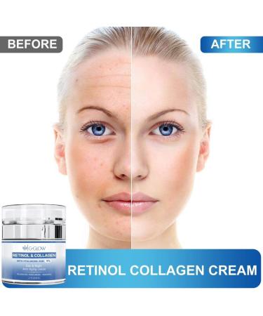 Retinol & Collagen Anti-Aging Cream with Hyaluronic Acid 5% | Day & Night Moisturizer for All Skin Types | Nourishing Firming Face & Neck Treatment - 50ml - Buy Online on GoSupps.com