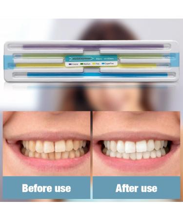 Buy MIIKUU Tooth Sandpaper Strips - 60pcs Dental Polishing for Oral Hygiene & Deep Cleaning - Buy Online on GoSupps.com