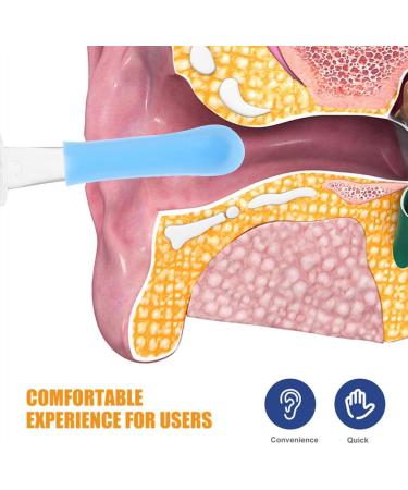 FRCOLOR 5pcs Silicone Ear Spoon Replacement Tips - Reusable Ear Wax Cleaner Tool (Sky Blue) - International Shipping Available - Buy Online on GoSupps.com