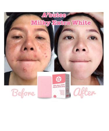 ARBUTEE Milky Extra White Brightening Acne Soap - B3 Glutathione & Alpha Arbutin | Removes Dead Skin Cells & Dark Spots | SLS-Free Paraben-Free | Maximum Strength (1 Bar Milky White + Mesh - Buy Online on GoSupps.com