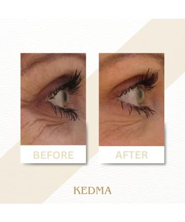 KEDMA Eye Cream 50 ml KED8 - Buy Online on GoSupps.com