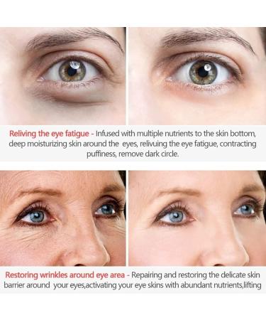Magic Eye Cream - Anti Aging Treatment for Under Eye Bags, Wrinkles, Puffiness & Dark Circles - Buy Online on GoSupps.com