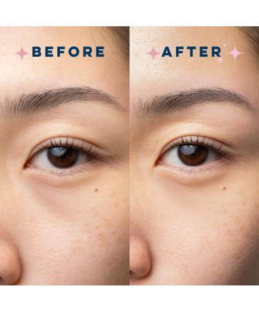 CLEAN SKIN CLUB Brightening+ Stem Cell Eye Cream, Reduces Dark Circles & Puffiness, Fragrance Free, 1.2 fl oz (Pack of 1) - Buy Online on GoSupps.com