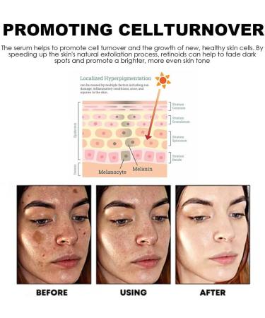 siduytin Women Portable Face Ladies Moisturizing Hydrating Blackspot Removal for Essence Blemish Remover Beauty Supplies - Buy Online on GoSupps.com