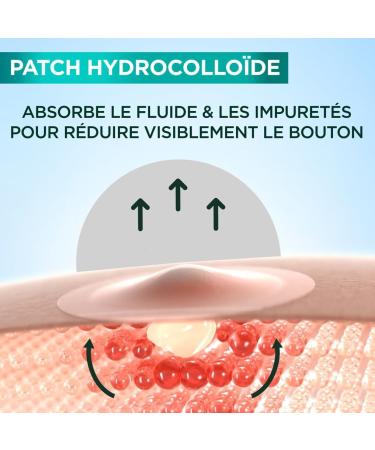 GARNIER Pure Active - XXL Pimple Patch Pack - Reduces the Appearance of Pimples in 8H* - Clinically Proven - Invisible & Ultra-Thin - Hydrocolloid Technology - Vegan & Cruelty-Free - Men & Women - Buy Online on GoSupps.com