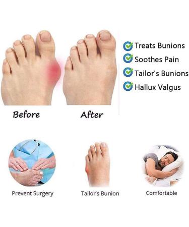Comfortable Platform Sandals for Women - Orthopedic PU Leather Shoes for Foot Correction - Ideal for Beach & Travel - Buy Online on GoSupps.com
