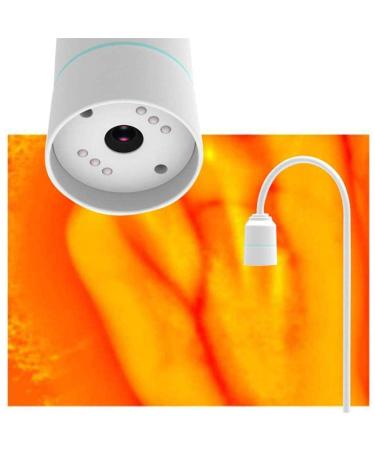 Samnuerly Medical Venensucher Venous Venue Professional Children Suitable Venous Viewer Showing Clear Image Venensucher on various skin areas