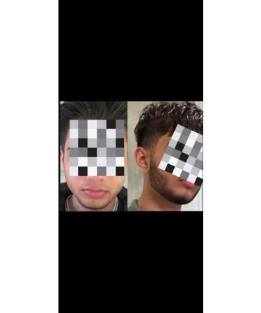 Revolution Natural Oil 100% Organic for Scalp & Beard includes Black Seeds Fenugreek seeds Aloe Vera Curry Leaves Castor/Rosemary/Coconut Oils Vitamin E Extract For Hair loss & Thickening - Buy Online on GoSupps.com