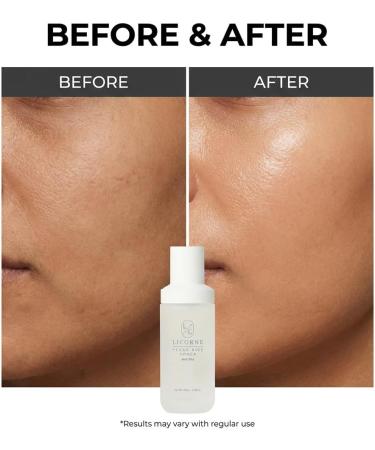LICORNE Vegan Rice Toner Daily Exfoliating Face Toner for Glass Skin AHA/PHA & Rice Water for Uneven Texture & Pores Gentle Resurfacing & Hydrating Essence Water 3.38 fl oz - Buy Online on GoSupps.com