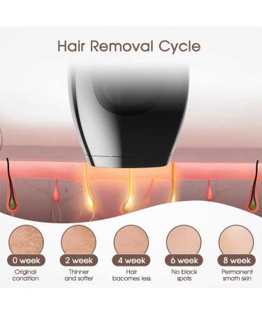 IPL Hair Removal Device with Ice Skate System - 5 Energy Levels 999 900 Light Impulses Permanent Painless Hair Remover (Black) - Buy Online on GoSupps.com