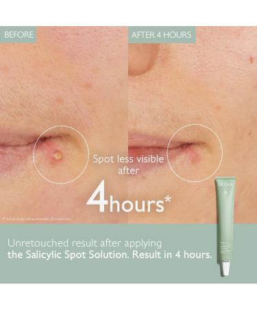 Caudalie Vinopure Salicylic Spot Solution - 15 mL - Buy Online on GoSupps.com